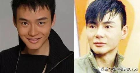 李民浩整容前后:有哪些男明星公开承认过整形？