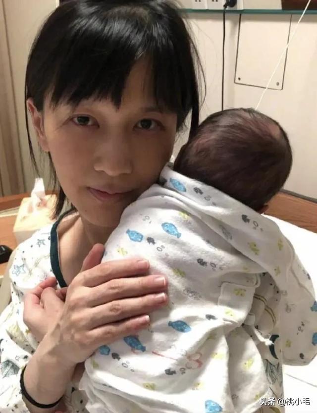 独眼喙鼻畸形孩子图片:怎样看待papi酱因为孩子随父姓被某些网友辱骂