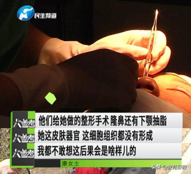 陈威翰整容前:被别人看出整过容，该如何化解？