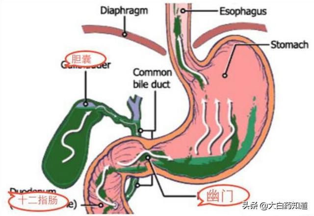 早上起床口苦,早上起床口苦是怎么回事？