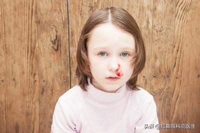 小孩鼻子出血怎么回事，儿童鼻子出血是什么原因