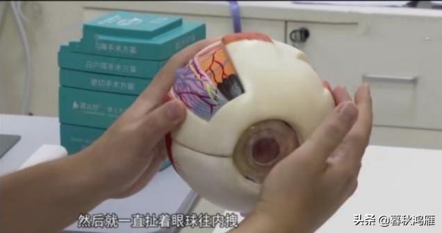 广东灵异事件小男孩:东莞一男孩疯狂玩游戏玩出了“斗鸡眼”进医院，到底是怎么回事？