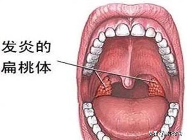 喉咙和咽喉的位置图片图片