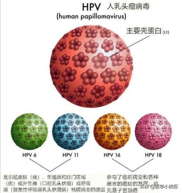 疣状表皮发育不良:女子打过hpv疫苗，6年后却查出宫颈癌，疫苗不管用吗，为何？