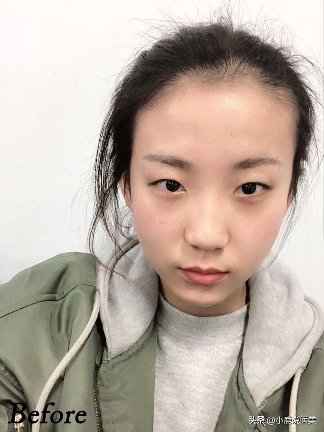 头条问答 你做整容后悔了吗 颜析hani的回答 0赞