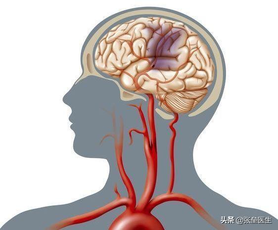 脑供血不足怎么办，脑供血不足头晕怎么办应该如何治疗