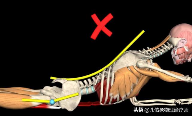 有腰肌劳损还能做俯卧撑吗：腰肌劳损做俯卧撑有用吗