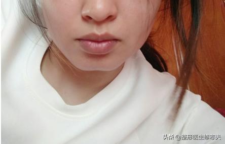 头条问答 - 女生下巴有美人沟是种什么体验?(8个回答)