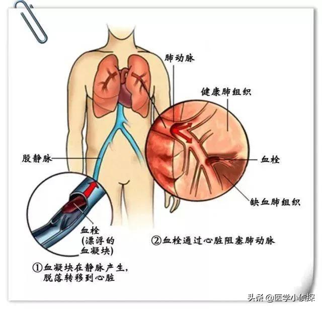 先天性心脏病的症状:先天性心脏病的症状有哪些呢 小儿先天性心脏病平时有什么反应？