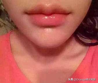 张檬整容记图片:为什么现在的女孩，已经长得很漂亮了还去整容？