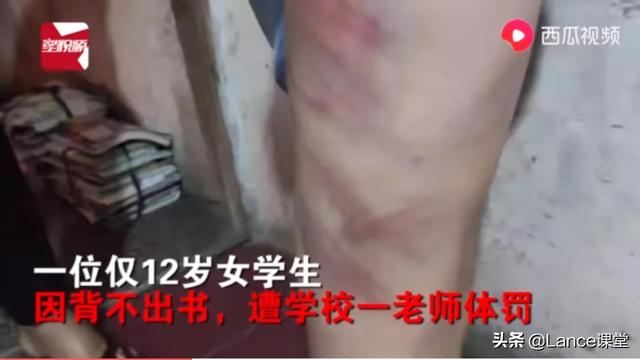 温州12岁女孩背不出书遭老师虐待抽打,双腿伤痕累累, 你怎么看？