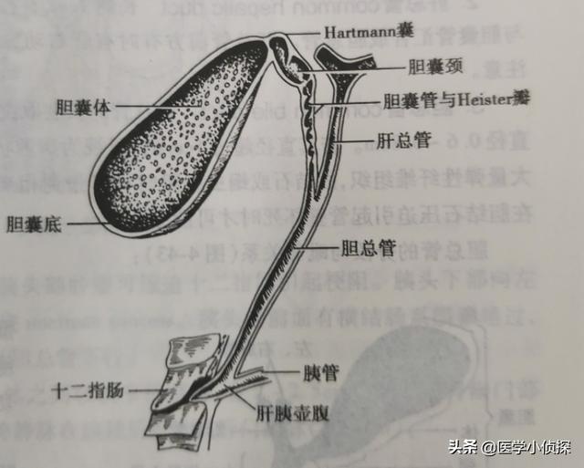 三大抗癌石,胆囊息肉、胆结石会转化为胆囊癌吗？
