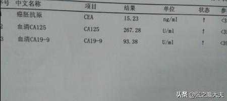 德国gimpet:验血能查出癌症吗?什么癌症可以提前发现？