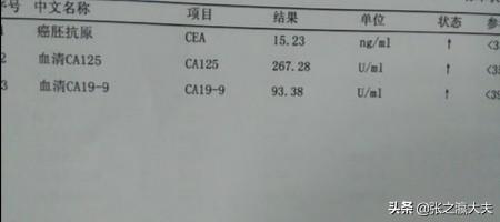 屎放大1000万倍，验血能查出癌症吗什么癌症可以提前发现