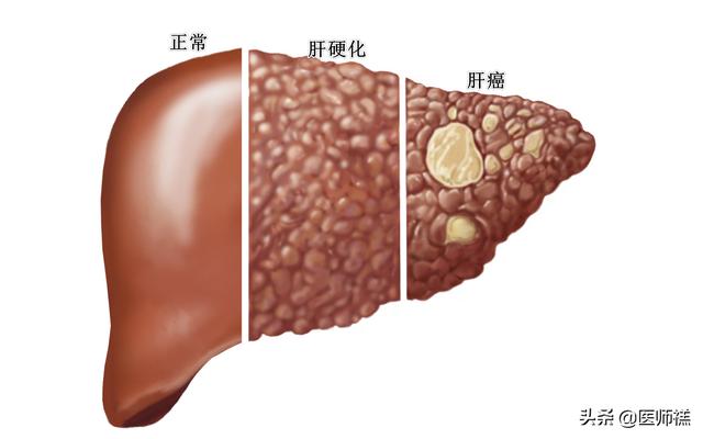 头条问答 