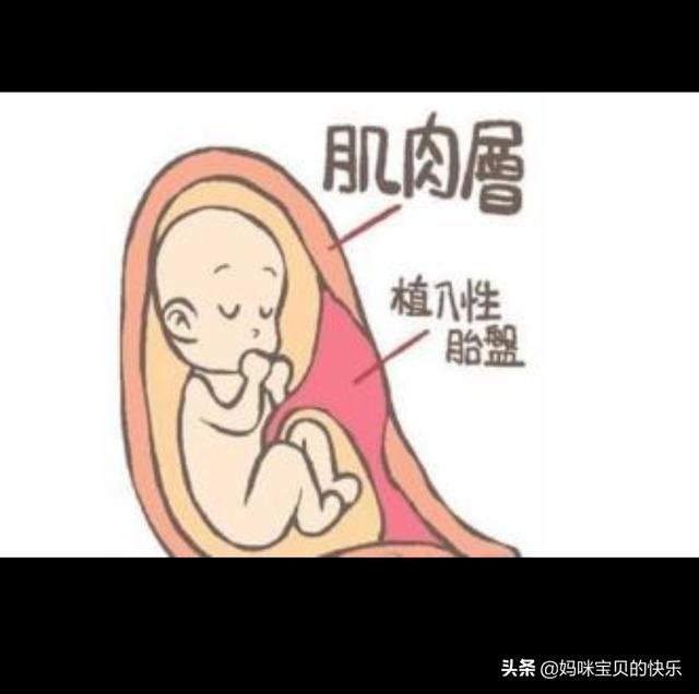 什么原因导致死胎呢:胎儿畸形是什么原因造成的？