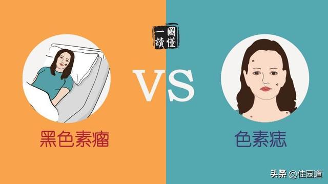 皮肤黑素瘤症状:皮肤恶性黑素瘤 黑色素瘤一般潜伏期多久？有何症状？