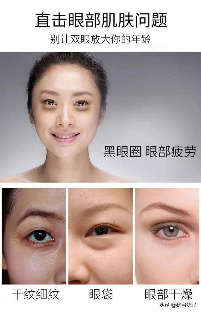 我现在才高中就有眼袋了该怎么办