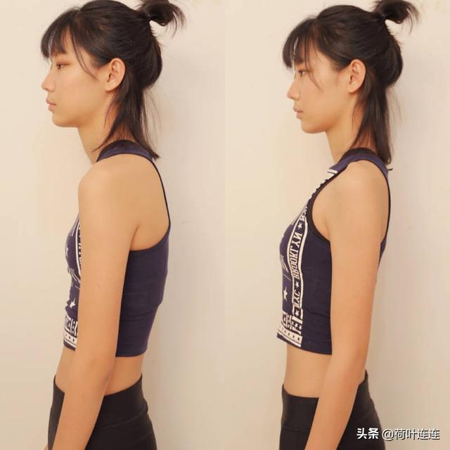 头条问答 - 6岁童驼背塌肩走路感觉没力气,是因为腰背力量不够么?