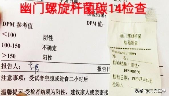 感染幽门螺杆菌,吃大蒜能不能消灭？无症状感染,要不要用药？