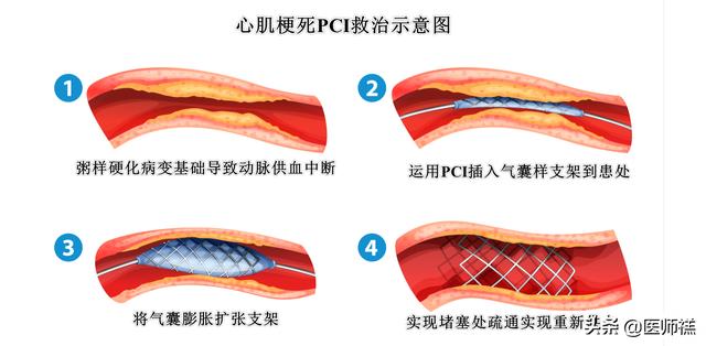 手术后的病症，手术后的病症病人是否一定要化疗