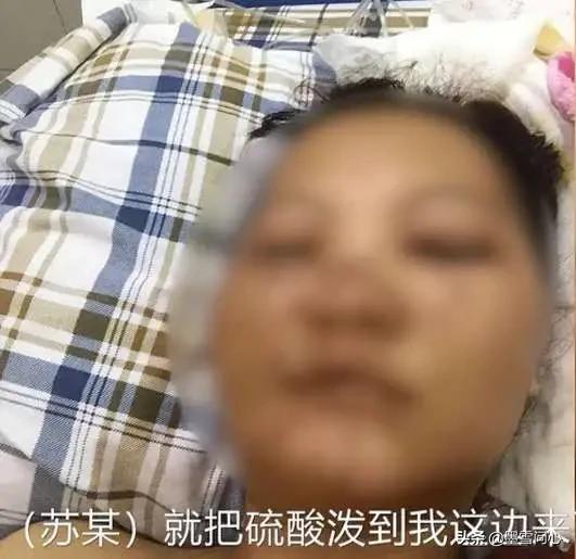 毁容女孩公开近照:3名女生被男生泼硫酸后，有些人竟然同情男生，为什么会这样？