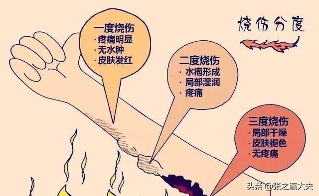 西昌火灾现场灵异事件:四川西昌为何频发火灾？是地理位置之类的原因吗？