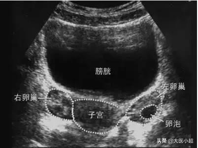 超声猫猫网:我家猫经常拉稀怎么办？医院检查不出来所以然？