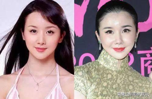 童菲整容前后:结婚以后，发现老婆是个人造美女，多处整形，你是什么感受？