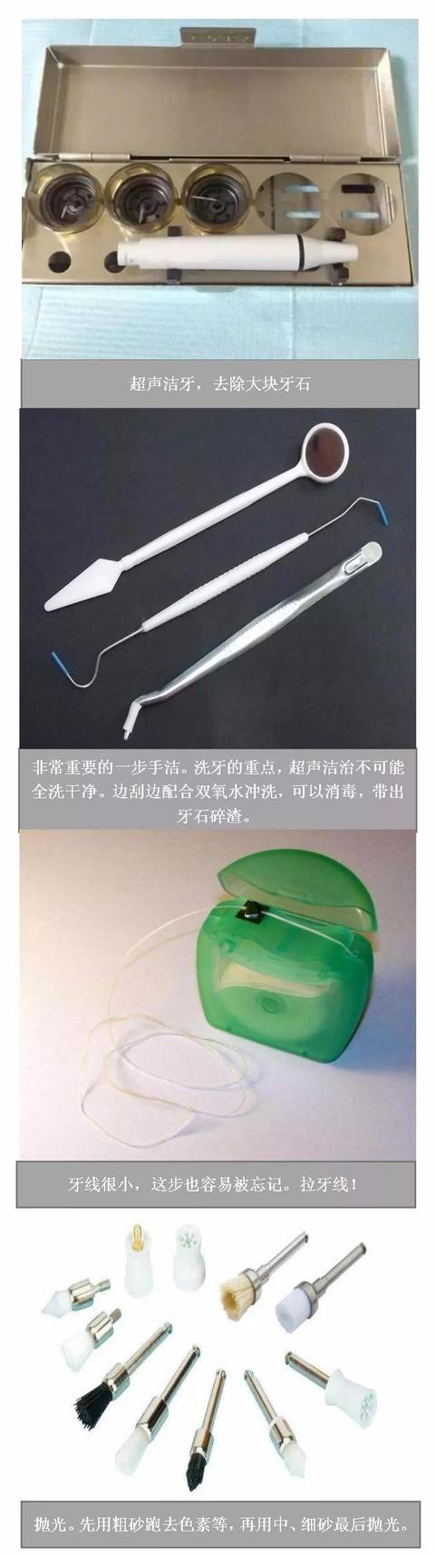 牙结石洗牙多少钱:有牙结石，去医院洗牙对牙龈和牙齿好吗？