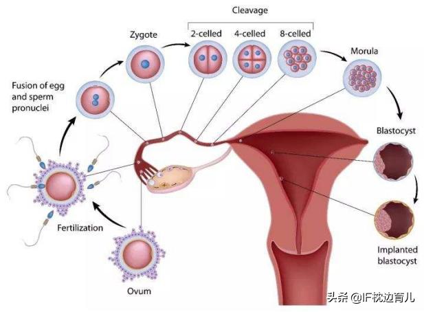 为啥带环后易发生宫外孕，体内植入避孕环对身体有哪些影响