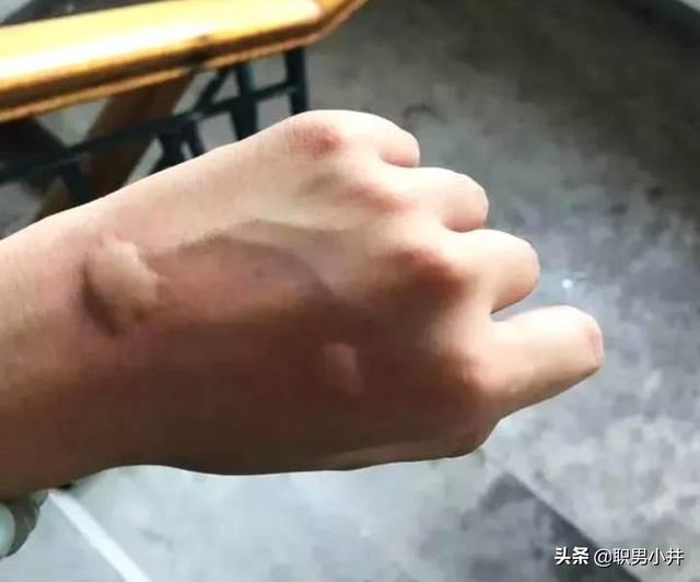 冈比亚鼠:如果地球上的老鼠全部灭绝会怎样？