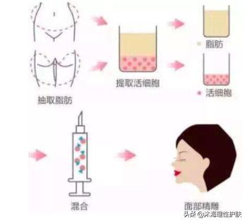 怎么治抬头纹(怎么治抬头纹男生方法)