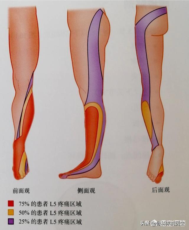 脊椎病的症状都有哪些:怎么辨别是否得了脊椎病？