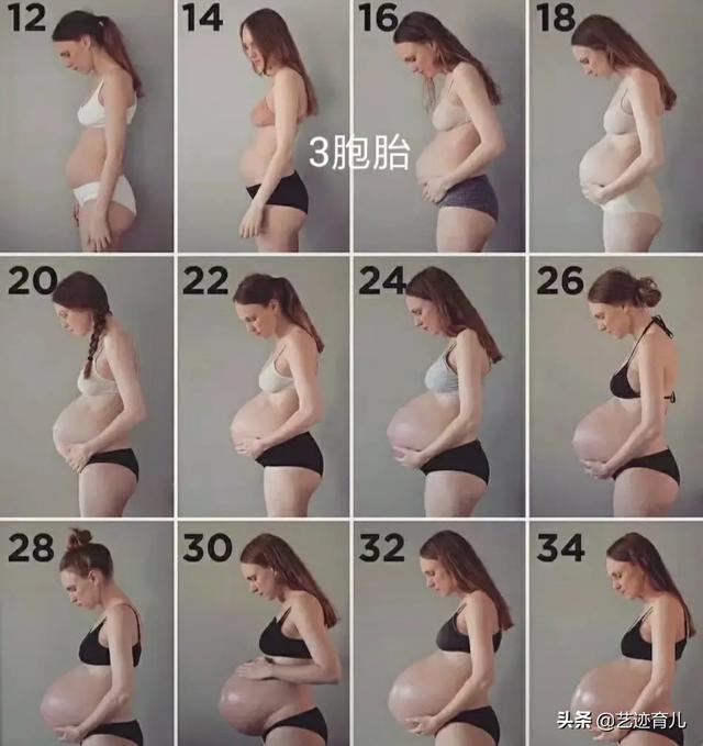 李湘怀二胎:为什么有的人怀孕完全没有孕吐呢