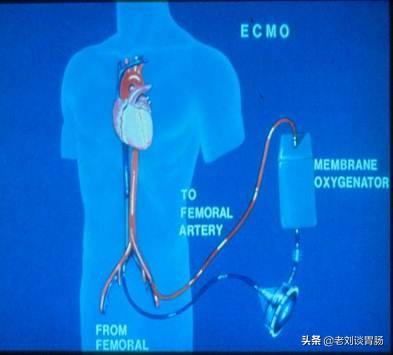 我想买个血糖仪，血糖仪哪个牌子准确