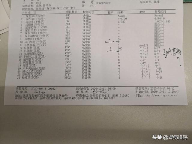 尿常规肾功能检查结果分析:尿肾功能五项检查结果分析 请问在尿检中哪一项检查，最能反应出肾脏受损？