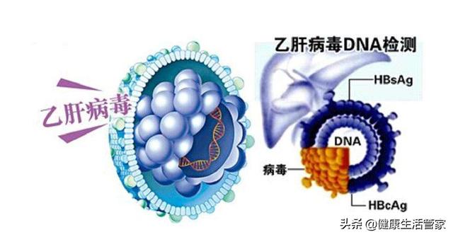 肝硬化的症状有哪些(肝硬化的症状有哪些)