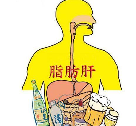 脂肪肝是怎么回事:脂肪肝是因为油脂吃得太多导致的吗为什么瘦的人也