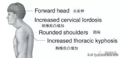 颈部牵引能使膨出恢复吗:颈椎前突锻炼方法有哪些？