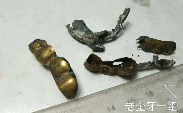 骨灰戒指:人死后火化，如果有金牙，火化的师傅会留下吗？