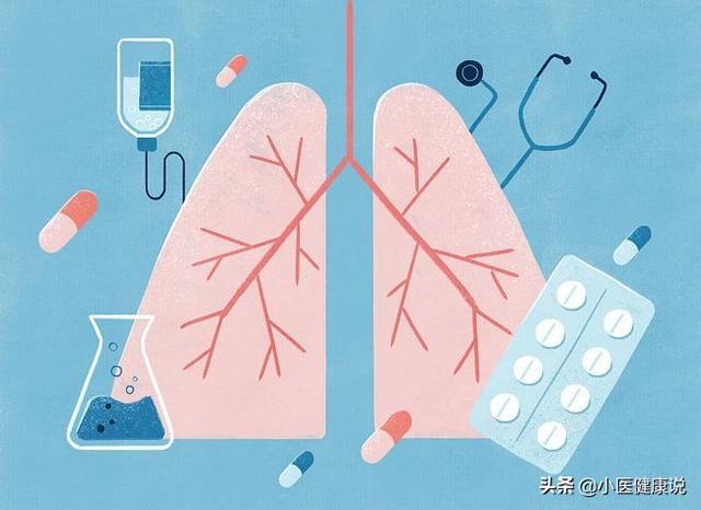 肺癌病人一直干咳怎么办:肺癌微创手术后干咳怎么办？