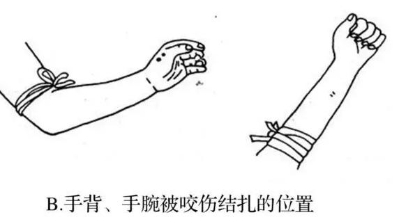短尾蝮蛇:蝮蛇有毒吗？为什么很多地区都有这种蛇？被咬后怎么办？