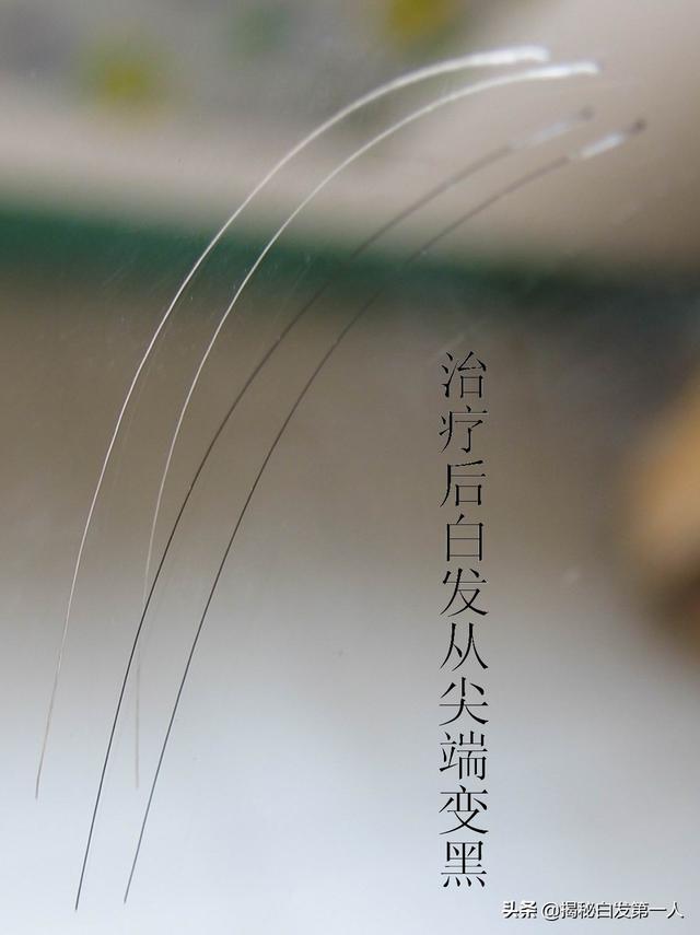 如何预防儿童感冒？插图29