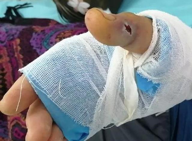 乌苏里蝮蛇:蛇泡到酒里，蛇身体里寄生虫会被酒泡死吗？喝了会感染寄生虫吗？
