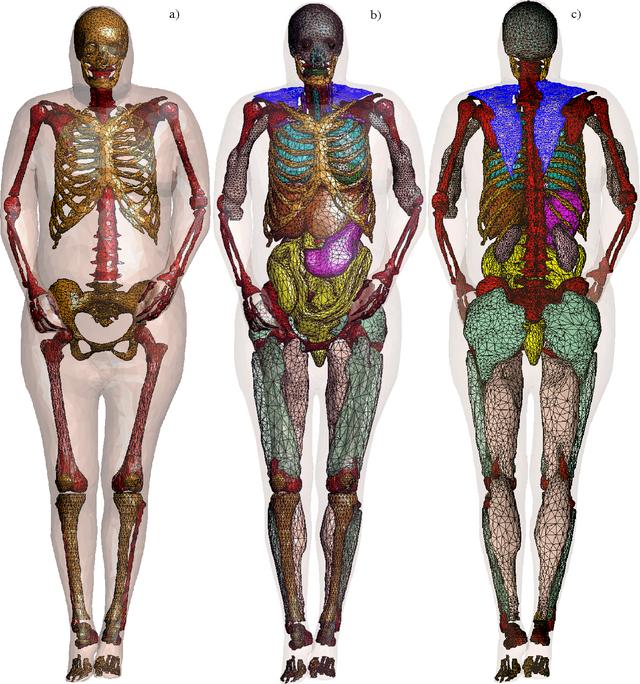 这个应该是与德国解剖学家冈瑟·冯·海根斯发明的人体塑化技术搞混了
