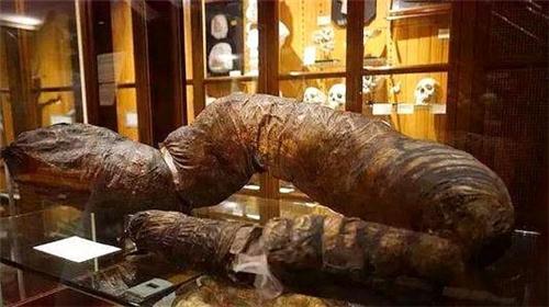 人多久不拉屎会导致死亡?