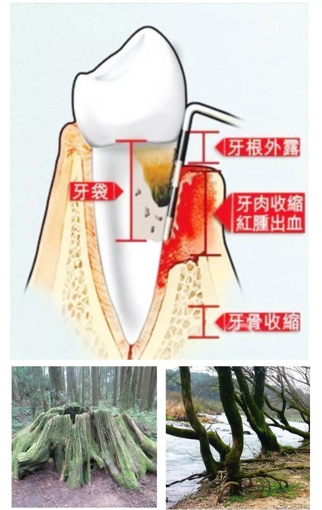 洗牙之前必须吃早餐吗:洗牙之前必须吃早饭吗 洗牙的过程是什么样的，洗完之后感觉如何？