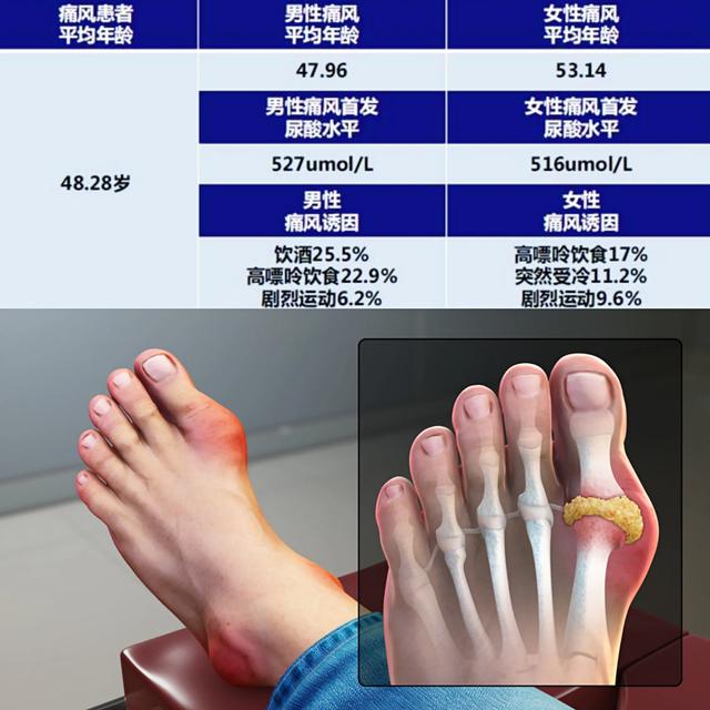 头条问答 为什么说痛风不能饮啤酒 那白酒可以喝吗 97个回答