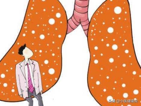 肺癌病人一直干咳怎么办:肺癌微创手术后干咳怎么办？